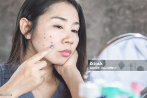 remove dark spots with ayurvedic solution tips get instant glow